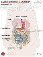 Diversione biliopancreatica con Duodenal Switch