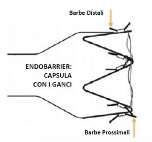 endobarrier